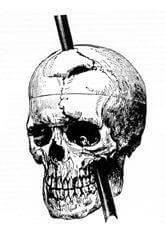 what is the phineas gage case study